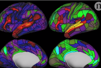 В мозге человека обнаружили сто ранее неизвестных областей