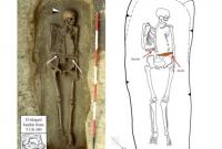 Археологи нашли в Италии скелет средневекового мужчины с рукой-ножом