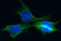 Ученые испытали на мышах средство против "бессмертных" раковых клеток