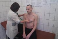 Российские тюремщики опубликовали фото Сенцова во время медосмотра
