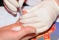 В Украине стартуют акции бесплатного тестирования на ВИЧ