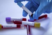 В Україні виявлено вже понад 73,8 тис. випадків COVID-19, за добу - 692 В Україні виявлено вже понад 73,8 тис. випадків COVID-19, за добу - 692