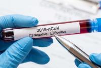 В мире зарегистрировали более 21 миллиона случаев коронавируса