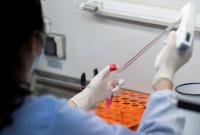 Середній темп приросту випадків коронавірусу в Україні становить 27%, - МОЗ