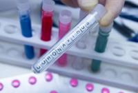 ИФА-тестирование во Львове выявило 600 человек с антителами к COVID-19