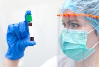 CNN: розробка вакцини може провалитися, світу доведеться вчитися жити з коронавірусом