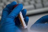 В Украине проверили девять подозрений на коронавирус: результаты отрицательные