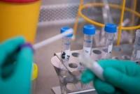 В Украине зафиксировали еще два случая инфицирования коронавирусом