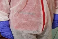 "Коронавірус доб'є медиків": Комаровський показав фото захисного костюма українського лікаря та "підірвав" мережу