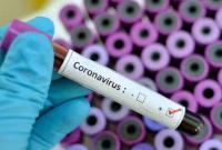 В Чехии более 1 тыс. человек заразились коронавирусом, умерших нет
