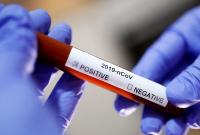 Появились новые экспресс-тесты для выявления коронавируса