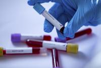В США начинают тестировать вакцину от коронавируса