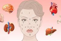 13 видов следов на лице, которые нам оставляют болезни
